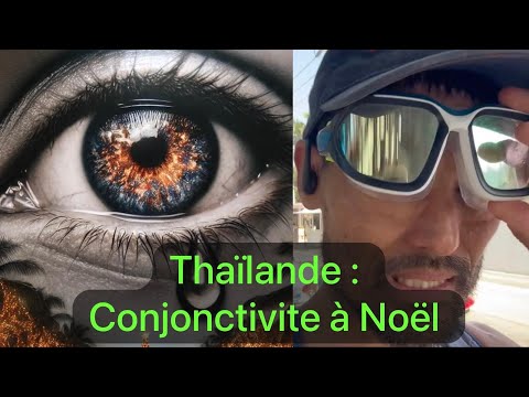 Ne tombe pas malade à Noël en Thaïlande! #conjonctivite #digitalNomad (Abonnez-vous svp)